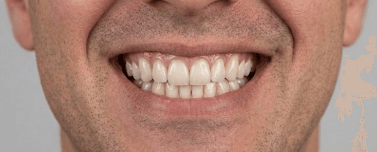 Before treatment, Case 1